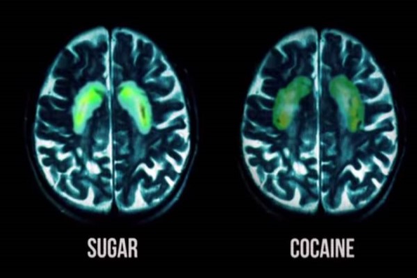Two brain scans, one of someone consuming sugar, the other of someone consuming cocaine, and both have the same portion of the brain lit up